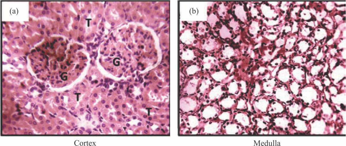 Image for - Cajanus cajan (L) Mill Sp. Leaf Extract Exacerbates Acute Renal Injury Induced by Acetaminophen in Albino Rats
