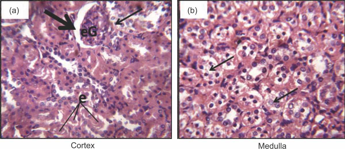 Image for - Cajanus cajan (L) Mill Sp. Leaf Extract Exacerbates Acute Renal Injury Induced by Acetaminophen in Albino Rats