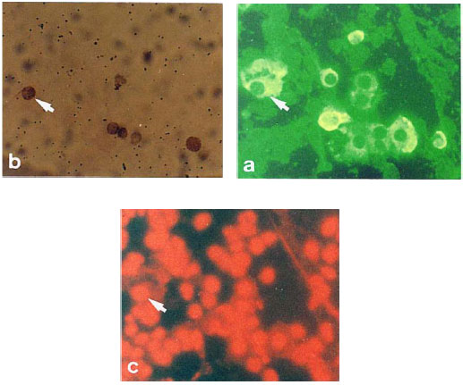 Image for - Effects of Dengue 2 Virus Inoculation on Toxorhynchites splendens Larvae
