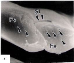 Image for - Scanning Electron Microscopic Study on the Cross Sections of Cocoon Filament and Degummed Fiber of Different Breeds/Hybrids of Mulberry Silkworm, Bombyx mori Linn.