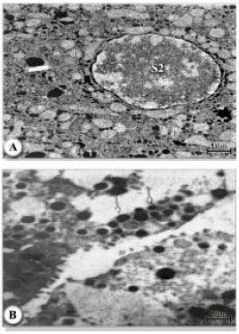 Image for - Histopathological Studies of Hard Tickes Hyalomma dromedarii Infected of Entomopathogenic Nematodes