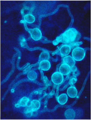 Image for - New Isolate Media of the Mosquito Pathogenic Fungus Lagenidium giganteum (Oomycetes: Lagenidiales) for Fungal Maintenance and Zoospores Release