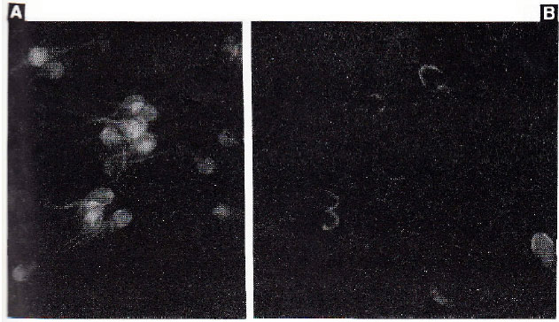Image for - Immunolocalization and the Effect of Cryopreservation on M1 Antigen of Ram Spermatozoa