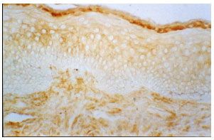 Image for - Histochemical Study of the Presence of Glycoproteins in the Skin-mucosa Transition Zone in Human Nasal Septum