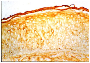 Image for - Histochemical Study of the Presence of Glycoproteins in the Skin-mucosa Transition Zone in Human Nasal Septum