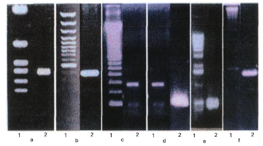 Image for - Inherited Susceptibility to Hyperandrogenic Manifestations In Pubertal Females: Idiopathic and Dyshormonogenesis