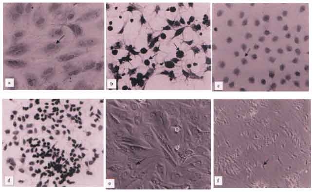 Image for - Effect of Bisphenol-A on the Sertoli Cell Culture from Prepubertal Male Wistar Rats