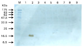 Image for - Optimization of Parameters for Accessory Cholera Enterotoxin (Ace) Protein Expression
