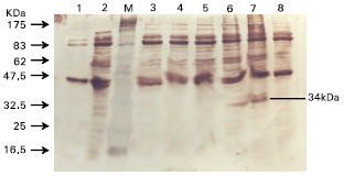 Image for - Optimization of Parameters for Accessory Cholera Enterotoxin (Ace) Protein Expression