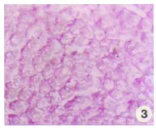 Image for - Pyrethroid Inhalation Induced Histochemical Changes in the Liver of Albino Rats