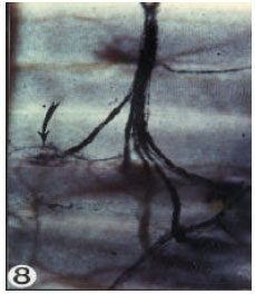 Image for - Acrylamide Administration Induces Neuromuscular Junction Degeneration
