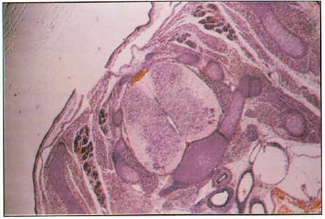 Image for - Effects of Maternal Diabetes on the Structure of Cervical Segments of the Spinal Cord in the Developing Fetus