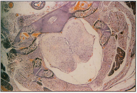Image for - Effects of Maternal Diabetes on the Structure of Cervical Segments of the Spinal Cord in the Developing Fetus