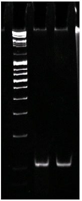 Image for - Diagnosis of Trichomonas vaginalis Infection by Urine PCR Analysis Compared to Wet Mount Microscopic Screening