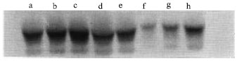 Image for - Avoiding Antibodies Interferences on Serum IgA Detection in Rheumatoid Arthritis