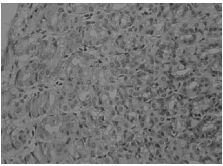 Image for - Inhibition of Gastric Mucosal Damage by Boric Acid Pretreatment in Rats