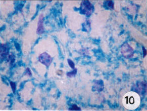 Image for - Exploring Hepatotoxicity of Benomyl: Histological and Histochemical Study on Albino Rats