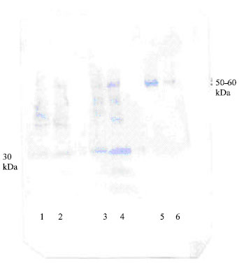 Image for - Discovery of the α-1 Microglobulin Complex in Urine Sample Patients with Cadmium Intoxication