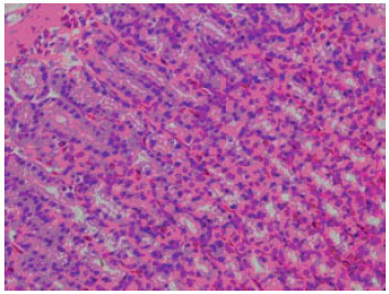 Image for - Gastric Antisecretory and Antiulcer Activity of Boric Acid in Rats
