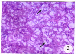 Image for - Exploring Hepatotoxicity of Benomyl: Histological and Histochemical Study on Albino Rats