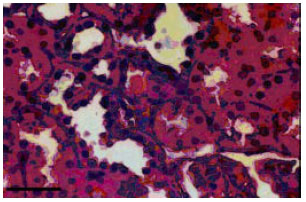 Image for - Effects of Valproat and Clonazepam on Kidney Tissue of Female Rats