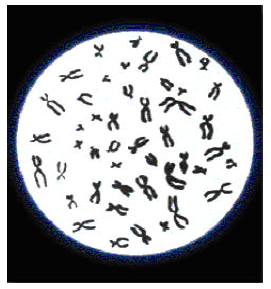 Image for - A Review of Deformable Curves from the Perspective of Chromosome Image Segmentation