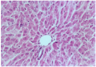Image for - Effect of Strobilanthes crispus on the Histology and Tumour Marker Enzymes in Rat Liver During Hepatocarcinogenesis
