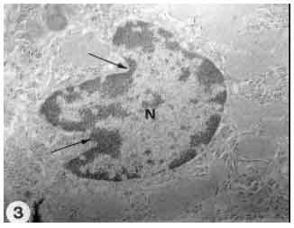 Image for - Morphological Evidence of Apoptosis in Hepatocytes of Rats (Rattus norvegicus) Exposed to Arabian Incense