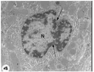 Image for - Morphological Evidence of Apoptosis in Hepatocytes of Rats (Rattus norvegicus) Exposed to Arabian Incense