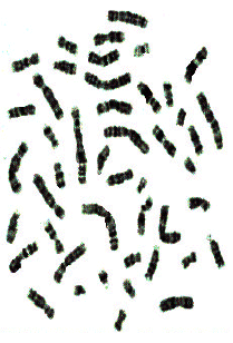 Image for - A Review of Deformable Curves from the Perspective of Chromosome Image Segmentation