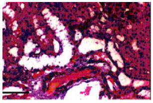 Image for - Effects of Valproat and Clonazepam on Kidney Tissue of Female Rats