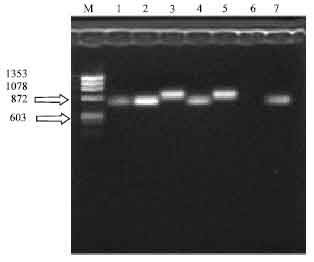 Image for - Identification of Enteropathogenic Campylobacters in Poultries` Faeces by PCR and its Comparison with Culture in Zahedan (Iran)