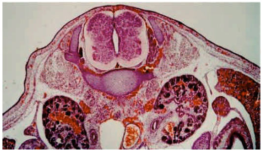 Image for - Effects of Maternal Diabetes on the Structure of the Lumbar Segments of the Spinal Cord in the Developing Fetus