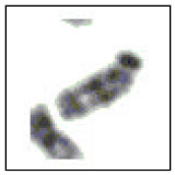 Image for - Segmentation of Chromosome Spread Images using Discrete Cosine Transform Based Gradient Vector Flow Active Contours: An Analysis
