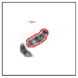 Image for - Segmentation of Chromosome Spread Images using Discrete Cosine Transform Based Gradient Vector Flow Active Contours: An Analysis