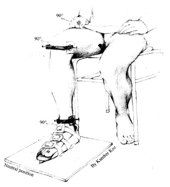 Image for - A New Clinical Design Measuring the Vertical Axial Rotation Through Tibial Shaft Resulting from Passive Knee and Subtalar Joints Rotation in Healthy Subjects: A Reliability Study