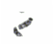 Image for - Discrete Cosine Transform Based Gradient Vector Flow Active Contours-A Suitable Tool for Chromosome Image Classification
