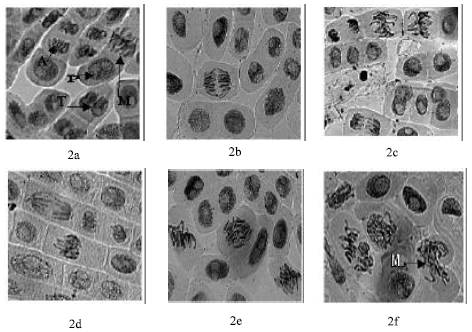 Image for - Antimitotic Effect of Colchicine from Six Different Species of Gloriosa in Onion Roots (Allium cepa)