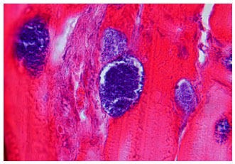 Image for - Detection of Sarcocystis Cysts from Meat Supplied for Hamburger in Iran by Histological Method