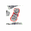 Image for - Discrete Cosine Transform Based Gradient Vector Flow Active Contours-A Suitable Tool for Chromosome Image Classification