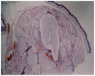 Image for - Effects of Maternal Diabetes on the Structure of the Lumbar Segments of the Spinal Cord in the Developing Fetus