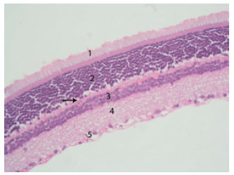Image for - Chloroquine-Induced Retinopathy in the Rat. Immunohistochemical and Ultrastructural Study