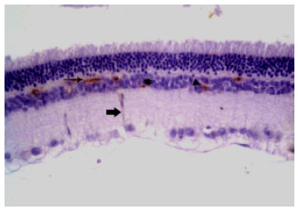 Image for - Chloroquine-Induced Retinopathy in the Rat. Immunohistochemical and Ultrastructural Study