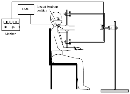 Image for - Effect of Tempromandibular Joint Sounds on Timing of the Masseter Muscle Activity in the Open-close-clench Cycle