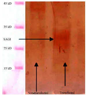 Image for - Enhancement of Antibody Immune Response to a Toxoplasma gondii SAG1-Encoded DNA Vaccine by Formulation with Aluminum Phosphate