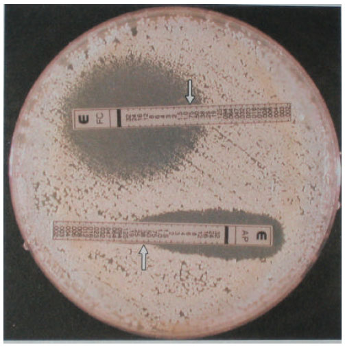 Image for - Epsilometer Test-Based Determination of Susceptibility of Clinically Important Candida Isolates to Conventional Antifungal Agents