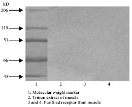 Image for - Purification of Beta Bungarotoxin (β-Bgtx) Binding Protein from Human Cadaver Skeletal Muscle