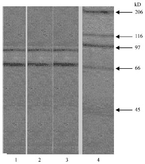 Image for - Purification of Beta Bungarotoxin (β-Bgtx) Binding Protein from Human Cadaver Skeletal Muscle