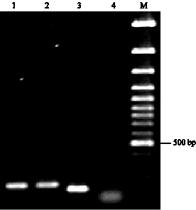 Image for - Genetic Characterization of Giardia intestinalis Strains from Patients Having Sporadic Giardiasis by Using PCR Assay 