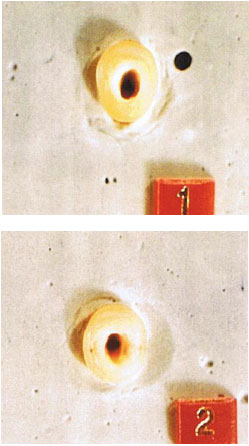 Image for - Comparison of Shear Strength of Amalgam Cores With and Without Post in Endodontically Treated Posterior Teeth